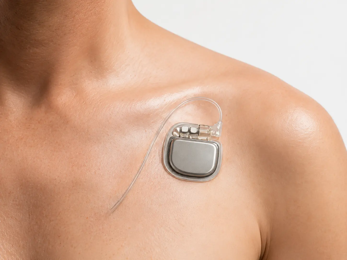 Concept-study board showing adaptive energy applied to a wearable system
